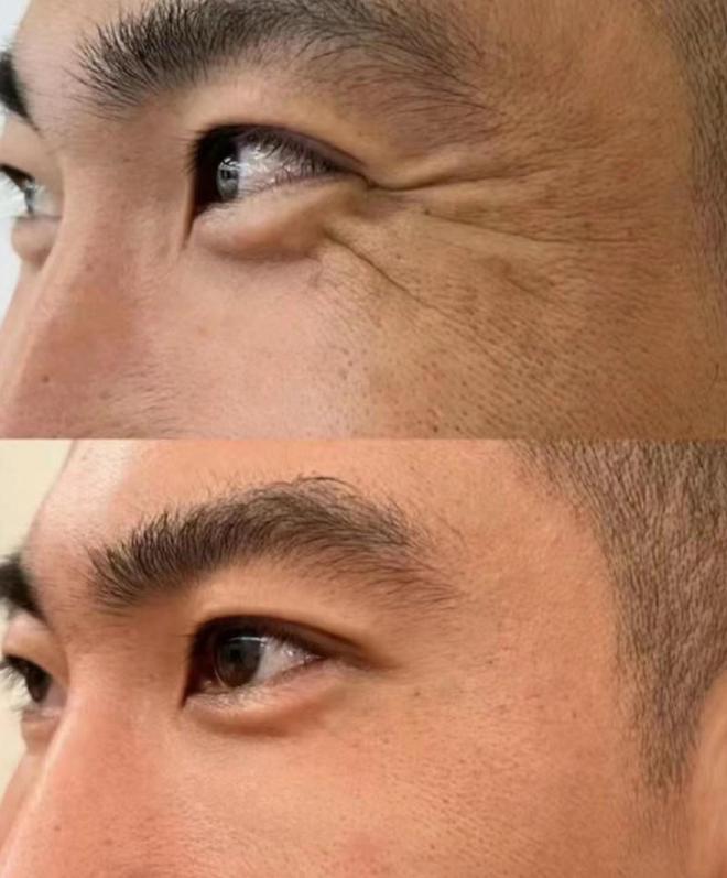 的护肤品推荐这几款口碑不可错过凯发K8旗舰厅AG客服抗皱紧致(图4)
