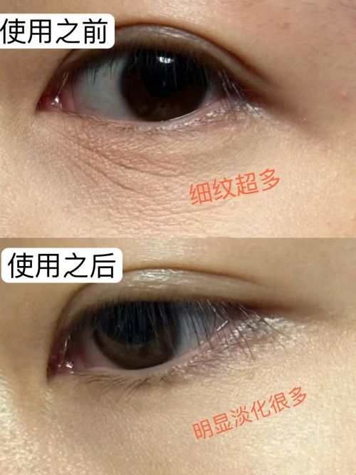 强！2025年最新眼霜排行评分榜单凯发K8登录入口抗皱眼霜排行榜前十(图2)