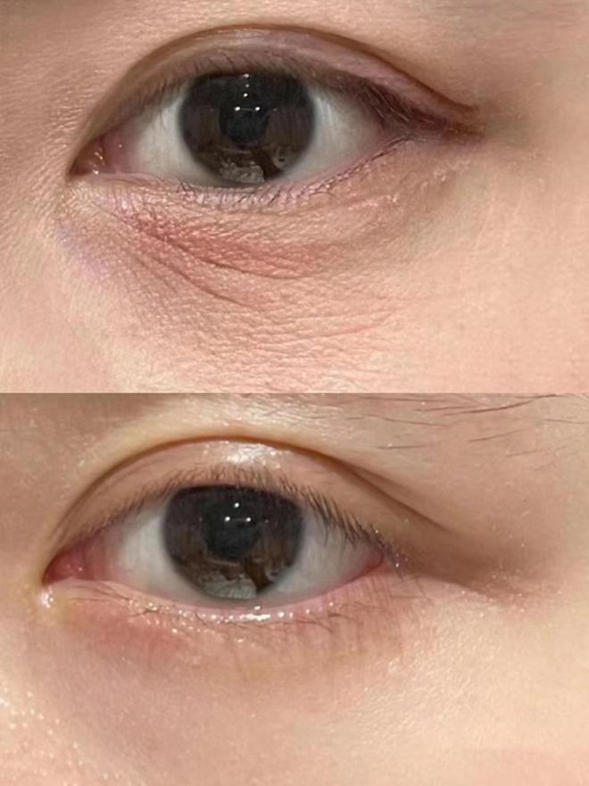 牌子好？只说真话选对眼霜不花冤枉钱k8凯发25岁男士眼霜去眼袋哪个(图6)